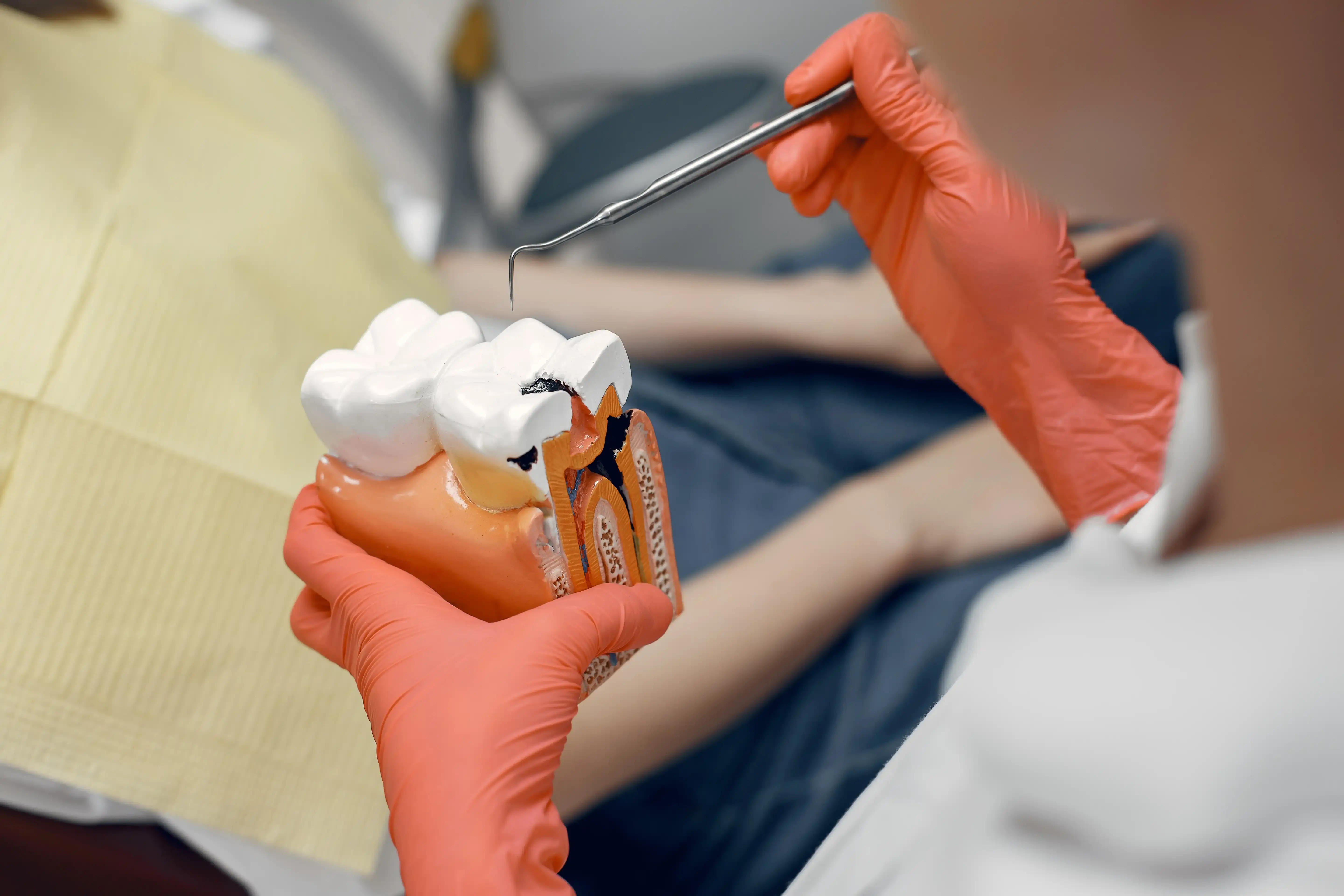 Cavity & Decay Treatment